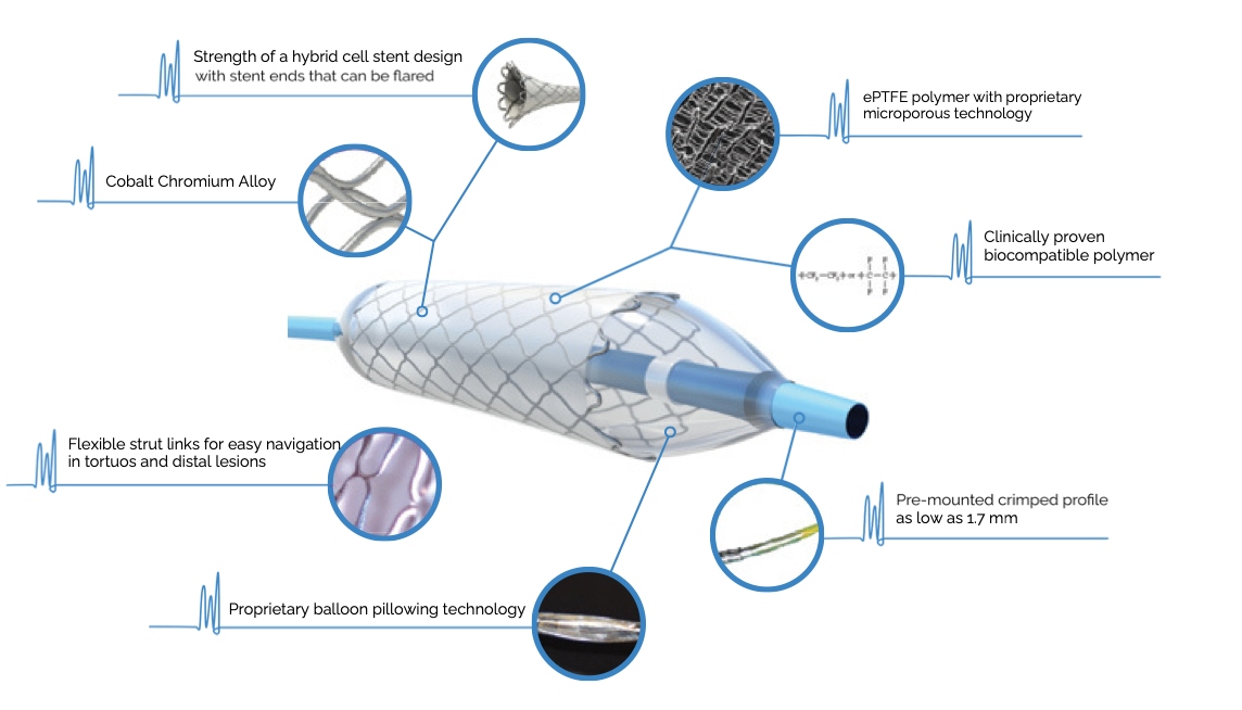 Silene™ product features and medical device