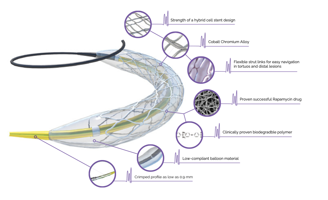 Siro™ product features and medical device